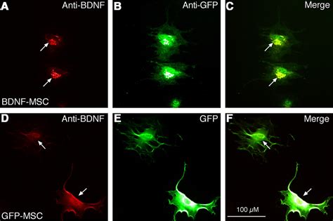 Mscs Engineered With Lentiviral Vectors Express Gfp Green And Bdnf