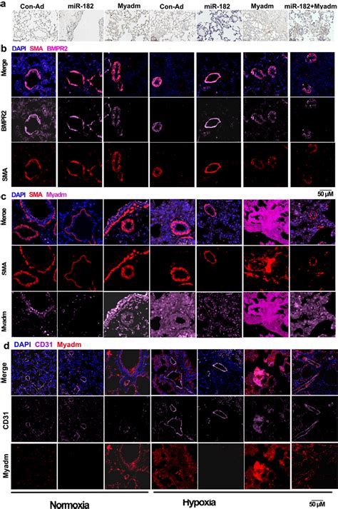 Overexpression Of Mir Regulates Myadm And Bmpr In Situ Expression