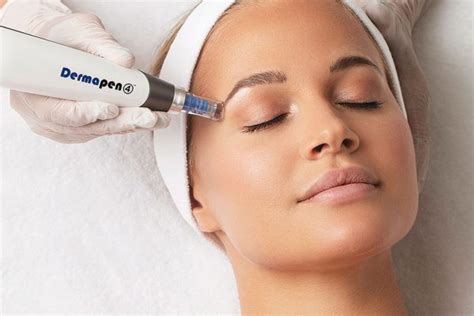 Dermapen Microneedling Aroa Estética Y Bienestar