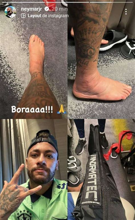 Neymar Mostra P Inchado Ap S Dois Dias Da Les O No Tornozelo Direito