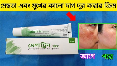 মেলাট্টিন ক্রিম ব্যবহার Melatrin Cream Uses মেছতা এবং মুখের কালো