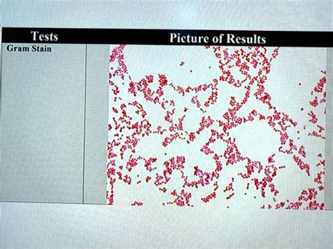 SOLVED: Tests Gram Stain Picture of Results