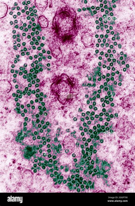 Colorized Cross Sectional Transmission Electron Micrograph TEM Of