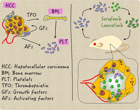 Treatment Of Hepatocellular Carcinoma With Autologous Platelets