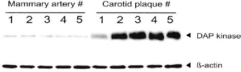 Figure 1 From Gene Expression Profiling Of Apoptosis Related Genes In Human Atherosclerosis