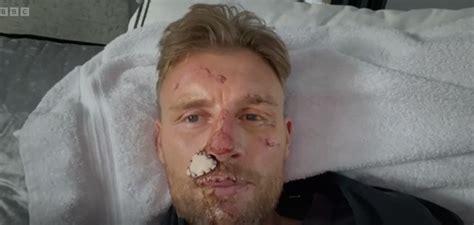 Freddie Flintoff Films Emotional Hospital Moment Days After Top Gear Crash