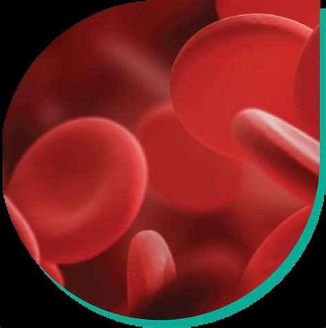 Sickle Cell Disease Al Borg Diagnostics Qatar