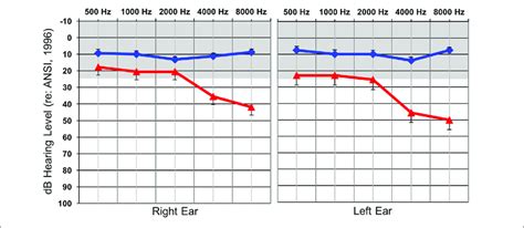 Average Hearing Thresholds DBHL Y Axis At Various Frequencies