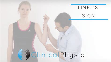 Tinel S Test For Cubital Tunnel Syndrome Clinical Physio YouTube