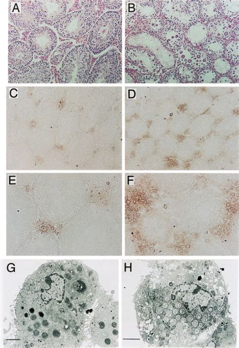 Testosterone Production In The Interstitial Cells Of Testis A And B