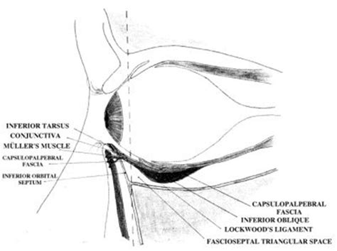 Orbital Cellulitis Diagnosis And Management ~ Dentistry And Medicine