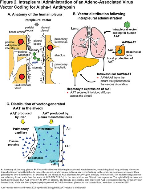 Intrapleural Gene Therapy For Alpha 1 Antitrypsin Deficiency Journal