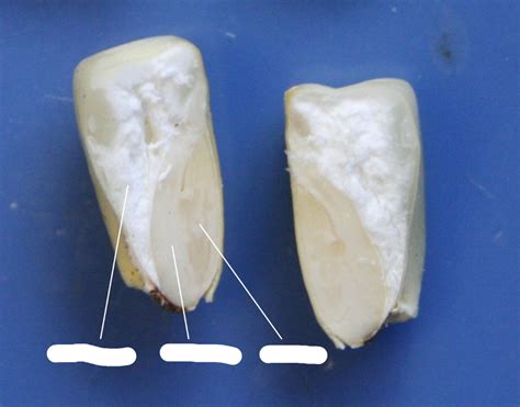 Corn Anatomy 1 Diagram | Quizlet