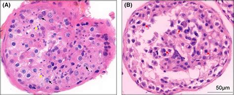 Pathological Haematoxylin And Eosin Staining Of Testicular Tissues From