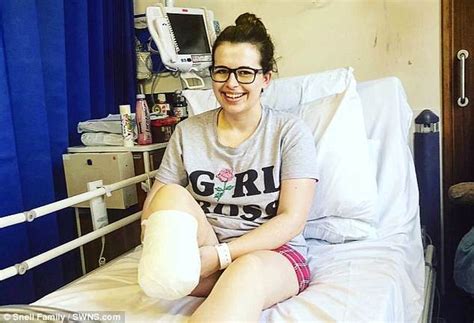 Woman Decided To Have Her Right Leg Amputated Daily Mail Online