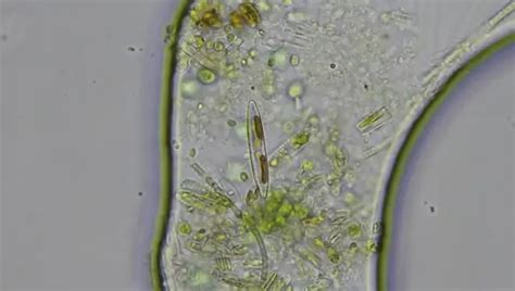 Diatoms A Complete Overview Microscope Clarity