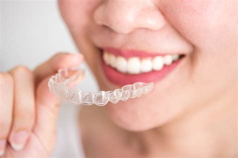 Aparat Invisalign Czym Jest I Jak Dzia A Niewidoczny Aparat