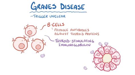 Graves Disease Video Anatomy Definition And Function Osmosis