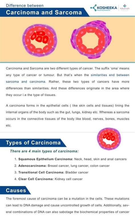 Carcinoma Vs Sarcoma Types Causespdf