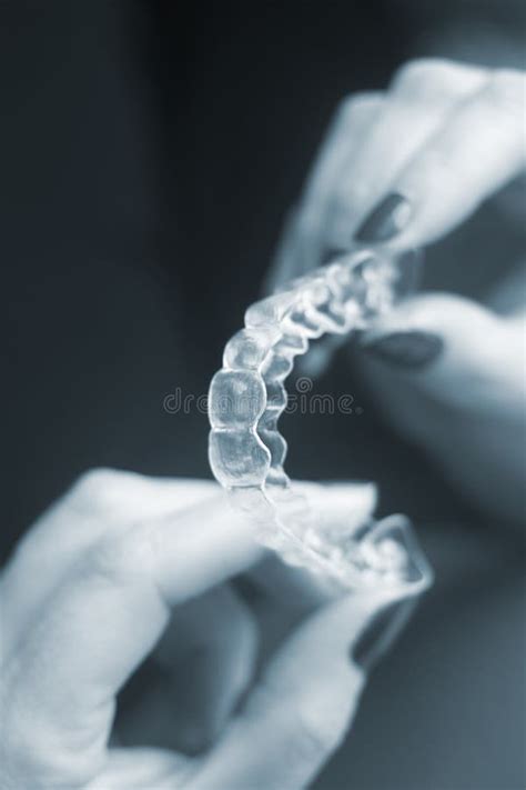 Clear Dental Teeth Retainers Stock Image - Image of aesthetic, female ...