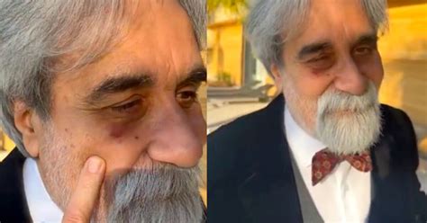 Festival Di Sanremo Incidente Per Beppe Vessicchio Cosa Successo Al