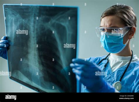 pulmonale  res stock photography  images alamy
