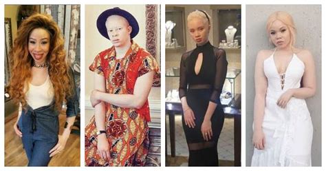 4 Albino Celebs In The Entertainment Industry Who Serve As Inspiration