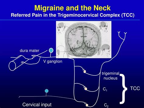 Ppt Migraine Pathophysiology An Update Powerpoint Presentation Id