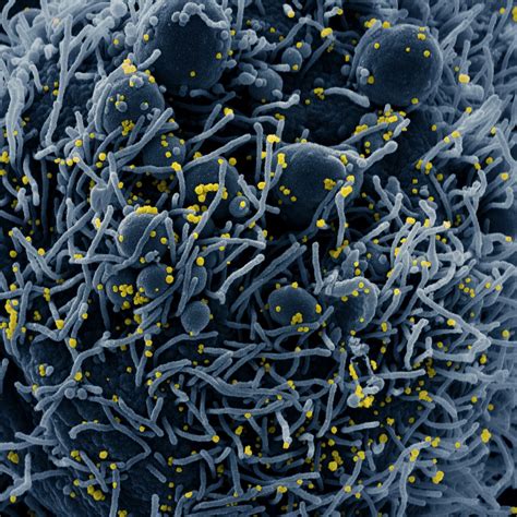 Electron Micrographic Images Of Sars Cov Bifrost