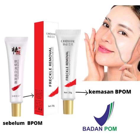 Jual Cindynal Krim Gr Salep Flek Hitam Membandel Diwajah Ampuh Dan