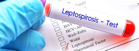 Leptospirosis C Mo Se Transmite S Ntomas Y M S Canalsalud