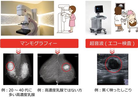 高濃度乳房（デンスブレスト）とは？ 乳腺専門医・認定医による乳がん診察・乳がん治療、横浜市のマンモグラフィー検査はサクラス乳腺クリニックへ