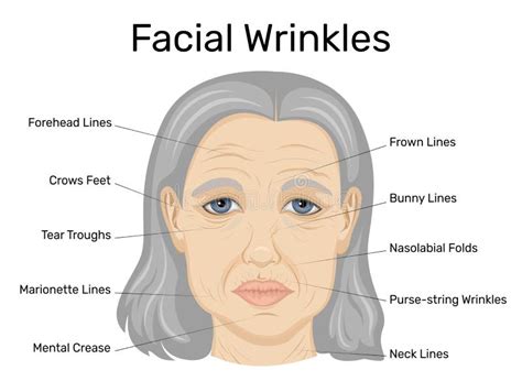 Wrinkled Forehead Angry