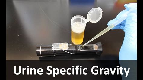 Urine Specific Gravity Refractometer Youtube