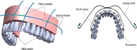 Applied Sciences Free Full Text New Trends In Dental Biomechanics