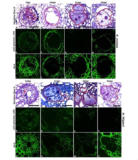 Immuno Fluorescence Imaging Of Galactan And MLG In Syncytia Induced