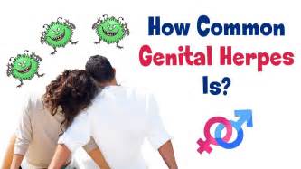 How Common Genital Herpes Is Causes Signs And Symptoms Of Genital