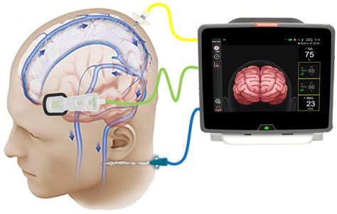 Sensors Free Full Text Near Infrared Spectroscopy Nirs In