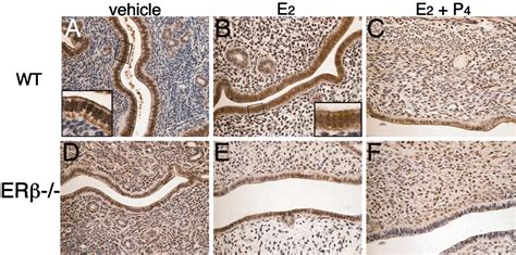 Role Of Estrogen Receptor β In Uterine Stroma And Epithelium Insights