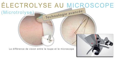 Lectrolyse Microscope Clinique De Soins Esth Tiques Excellence