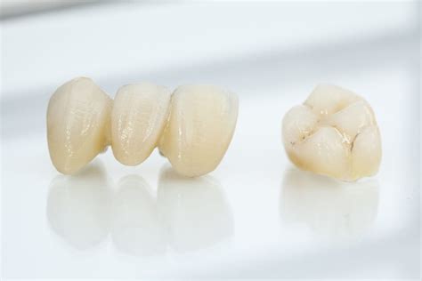 Zirconium Bridges Holistic Dentistry In Costa Rica Natural Dental