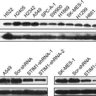 Knockdown Of Stim Expression Induced Cell Cycle Block In Nsclc Cells