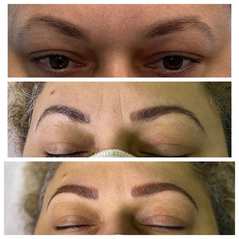 All 97 Images Microblading Pictures Before And After Latest