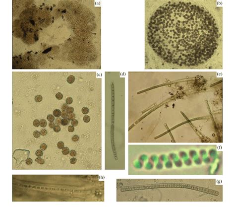 Cyanobacteria Microcystis wesenbergii ((a, b) colonies, (c) single... | Download Scientific Diagram