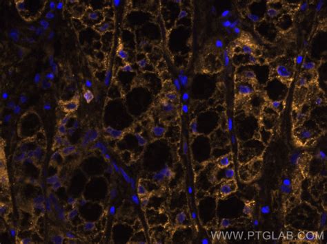 Asgr1 Polyclonal Antibody Coralite® 555 Cl55511739100ul