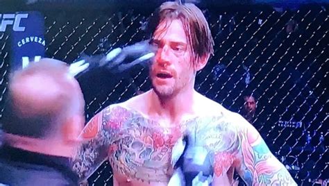 Cm Punk Taken To Hospital After Another Embarrassing Ufc Loss