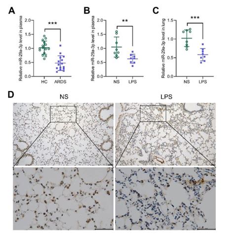 Mir A P Improves Lung Injury In Ali Mice A He Staining Of Lung