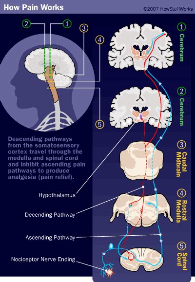 This Shows How Pain Works In Your Body