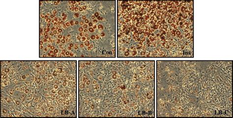 Oil Red O Staining Results Of The Lipid Drop Accumulation Assay For