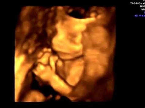 20 Weeks 4D Ultrasound GENDER REVEAL YouTube